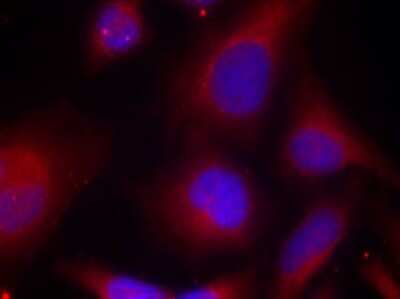 Immunocytochemistry/ Immunofluorescence: MARCKS [p Ser158] Antibody - BSA Free [NBP3-05422]